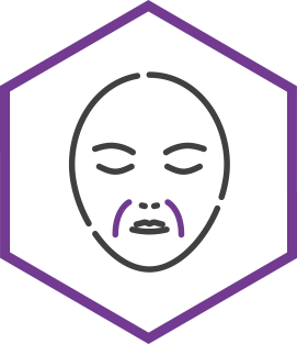 Nasolabial folds